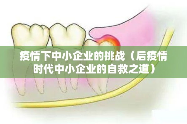 疫情下中小企业的挑战(后疫情时代中小企业的自救之道) 疫情下中小企业的挑战(后疫情时代中小企业的自救之道)
