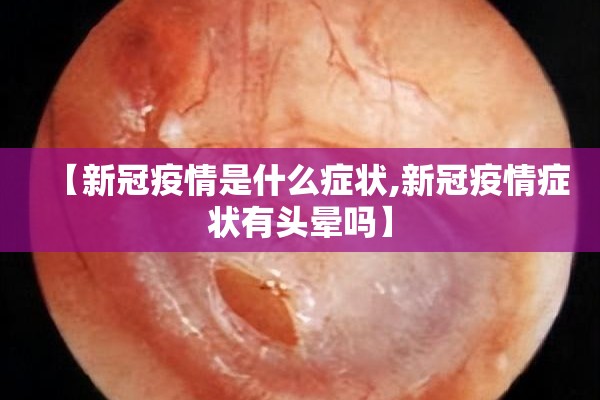【新冠疫情是什么症状,新冠疫情症状有头晕吗】